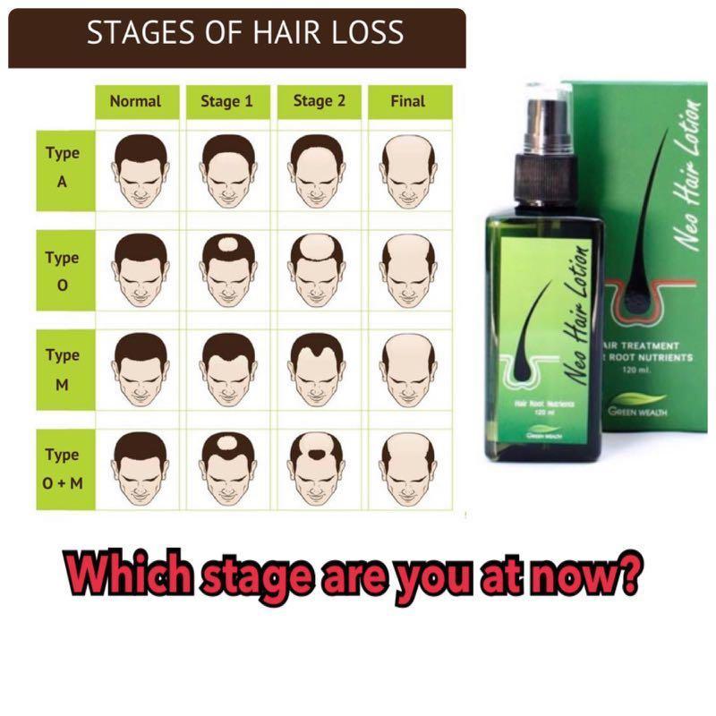 Neo Hair Lotion Hair Growth Oil for Stronger Thicker Longer Hair 120ml - Image 9